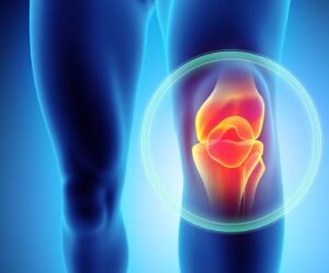 Knee pain - skeleton x-ray