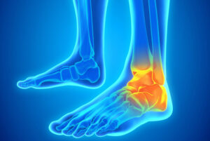 ankle pain garno ankle support 2